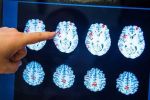  دماغ الرجل أم المرأة.. دراسة تكشف 'الفارق المذهل'
