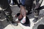 اعتقال 3 شبان في مواجهات شمال القدس 