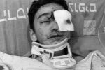 القدس: الطفل مالك عيسى 9 سنوات اصيب برصاصة مطاطيه احتلالية قد تفقده عينه