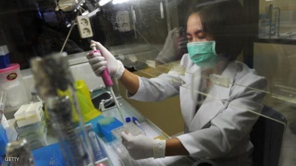 علماء ينجحون في إزالة الإيدز من الدم