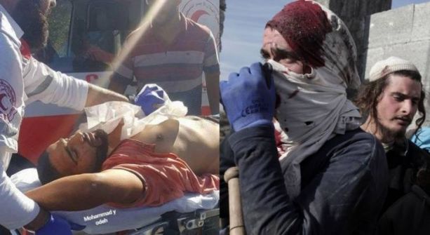 إصابة خطيرة لشاب برصاص الاحتلال في قصرة جنوب نابلس