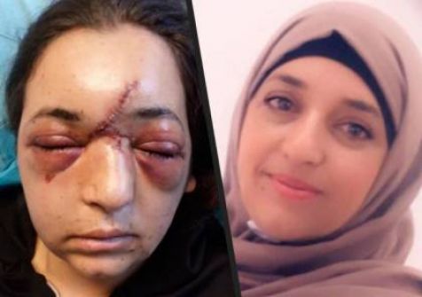 هآرتس: جندي إسرائيلي تسبب بكسر جمجمة سيدة في العيسوية